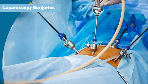 Laparoscopic Surgery