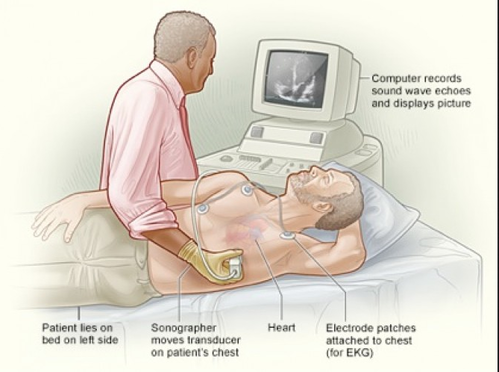 Echocardiography