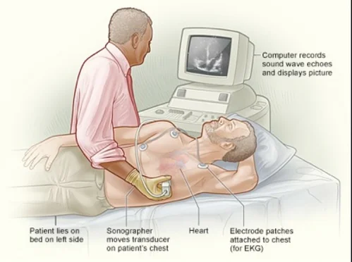 Echocardiography